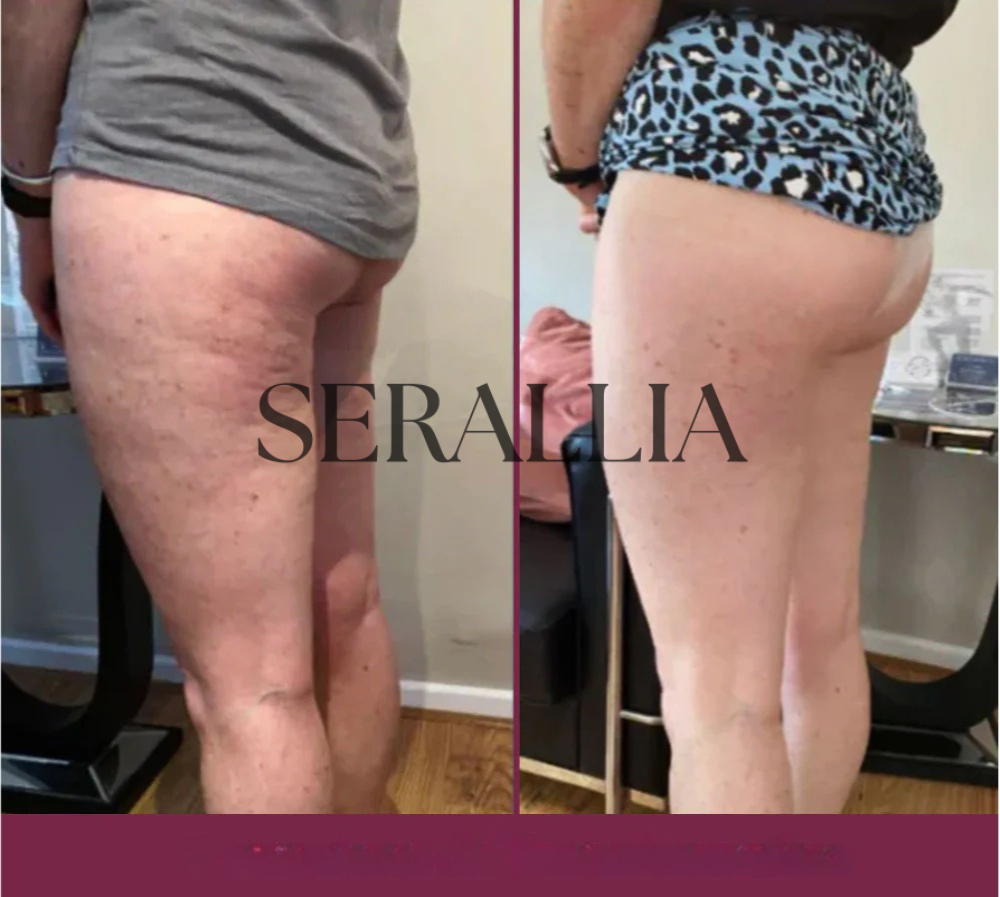 Sofia L, Seattle – USA