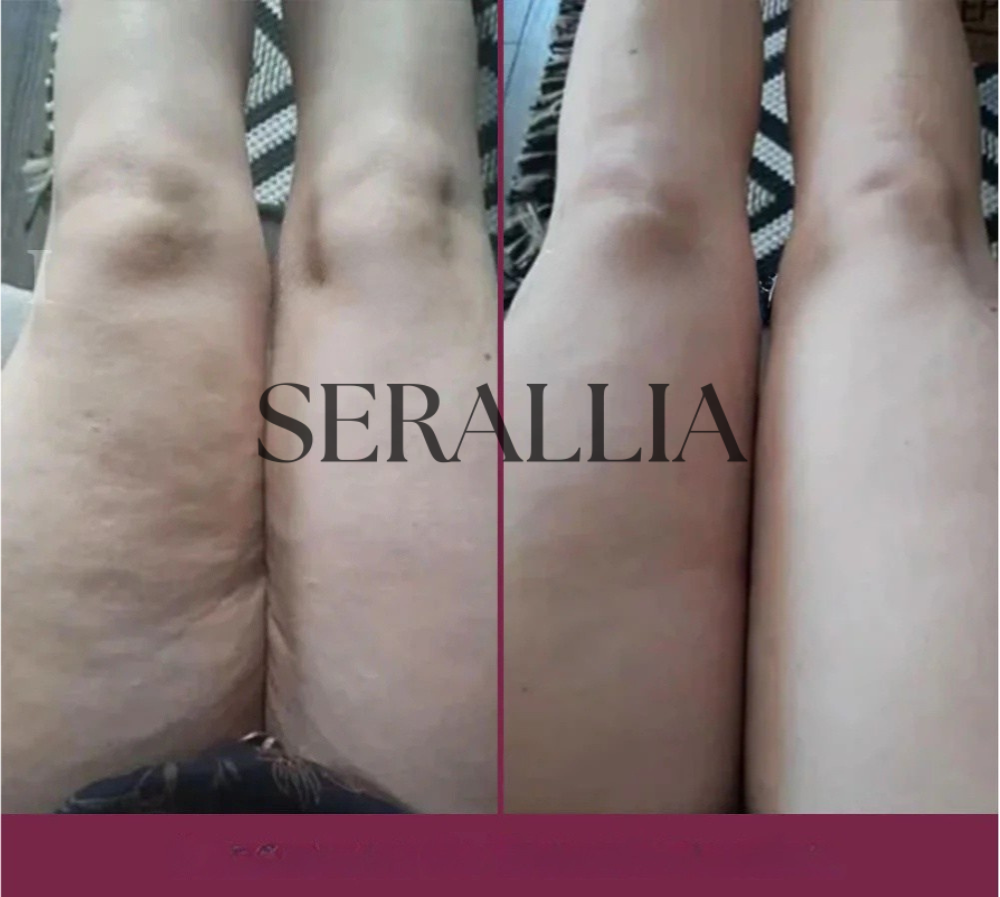 Hannah T, Miami – USA